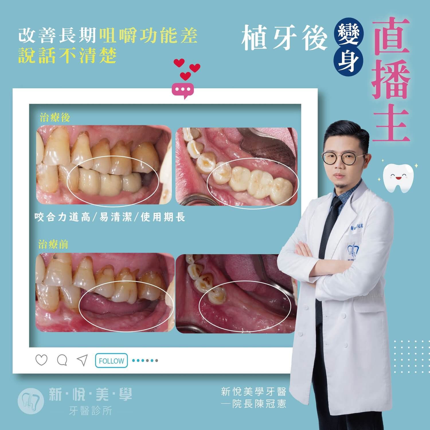 新悅美學牙醫診所的案例分享圖片